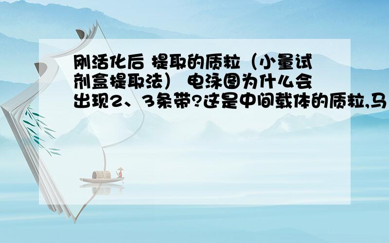 刚活化后 提取的质粒（小量试剂盒提取法） 电泳图为什么会出现2、3条带?这是中间载体的质粒,马上要酶切 之后链接,之前是因为没有链接成功,所以怀疑是不是提取的质粒有问题,以前没怎么